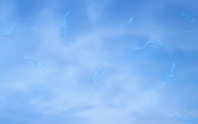 When to Be Concerned About Eye Floaters in Your Vision